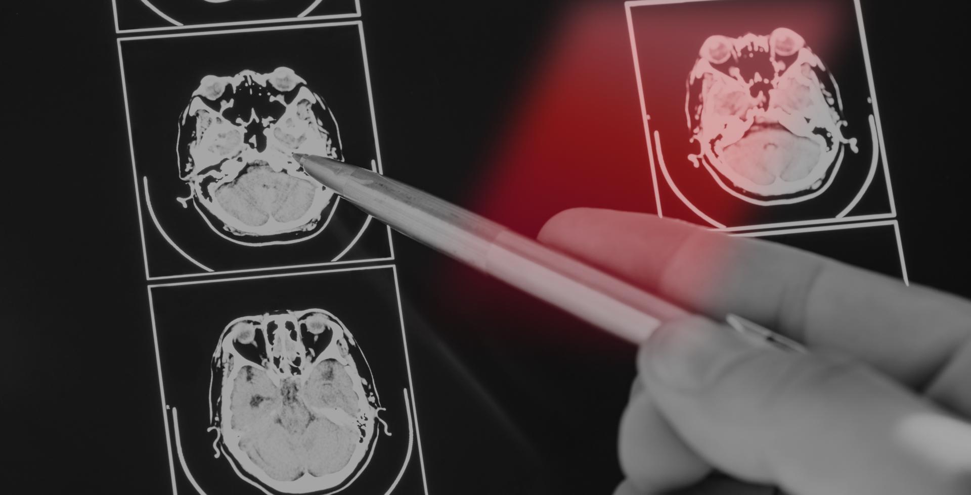 히스토리 - 뉴로핏